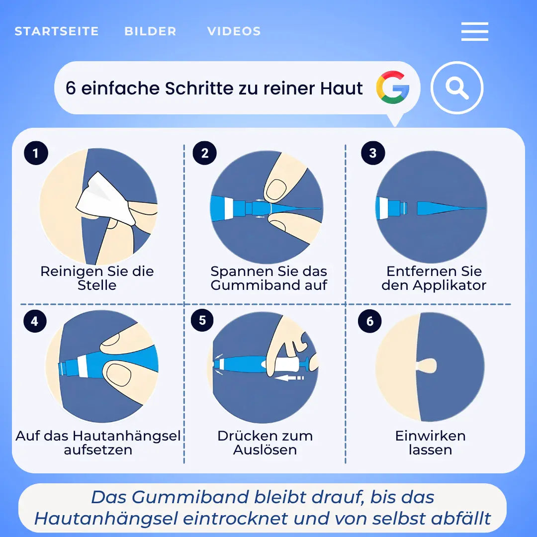 Mildara TagFrei™ Komplett-Set