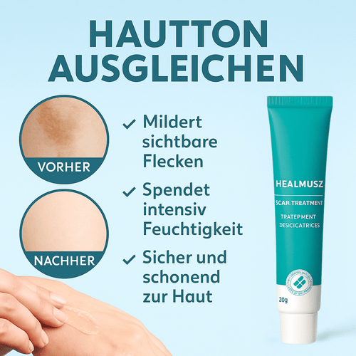 Mildara Hautton-Ausgleich Gel mit medizinischem Silikon