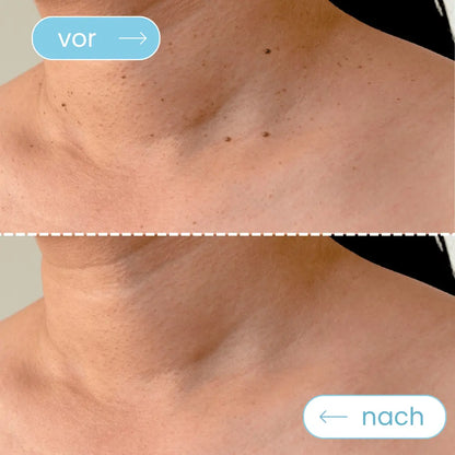 Mildara TagFrei™ Komplett-Set