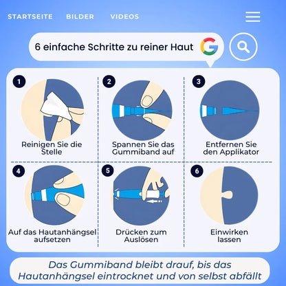 Mildara TagFrei™ Komplett-Set